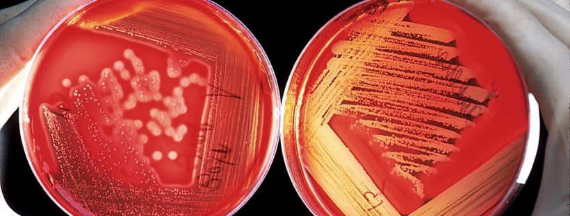 health studies on carrageenan